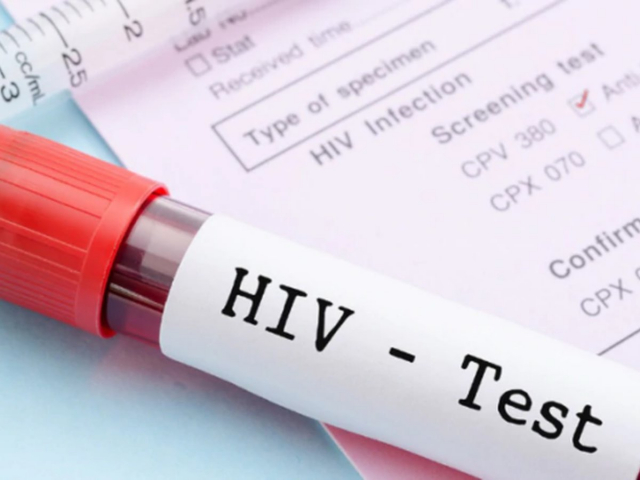 Día Mundial de la lucha contra el Sida: Mitos y verdades