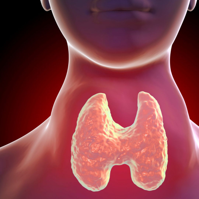¿Qué es el hipertiroidismo?